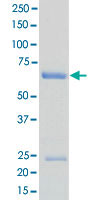 Loading 1 &mu;g protein in SDS-PAGE